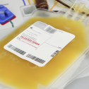 A full bag and the equipment used for donating plasma Plasma for profit